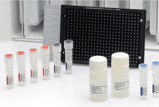 PCR ARRAY of Mouse Osteoporosis