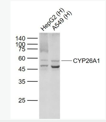 (x)ɫcP450 CYP26A1ؽMÆο¡w