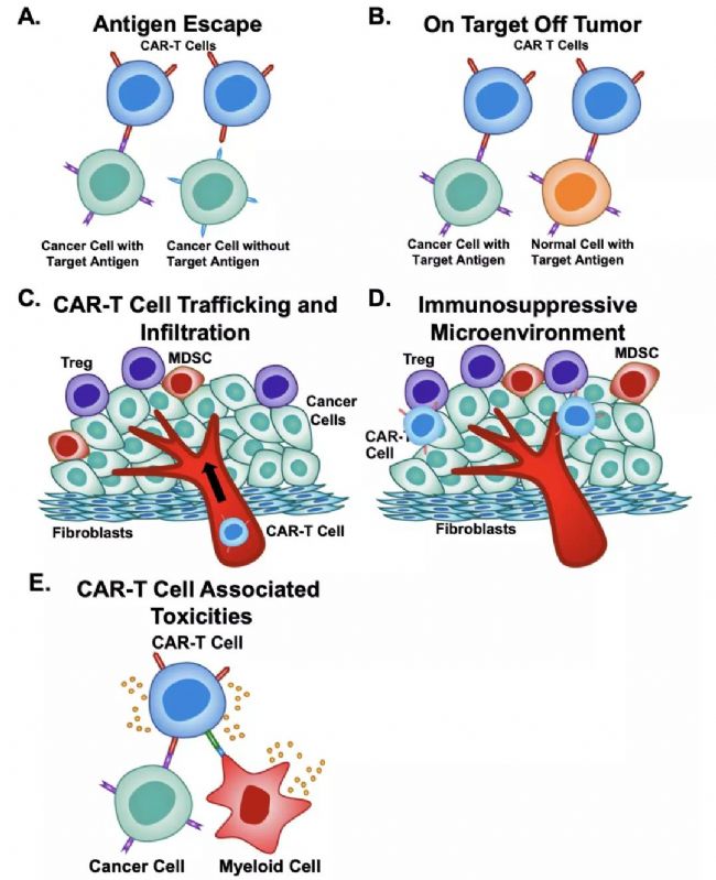 CAR-T