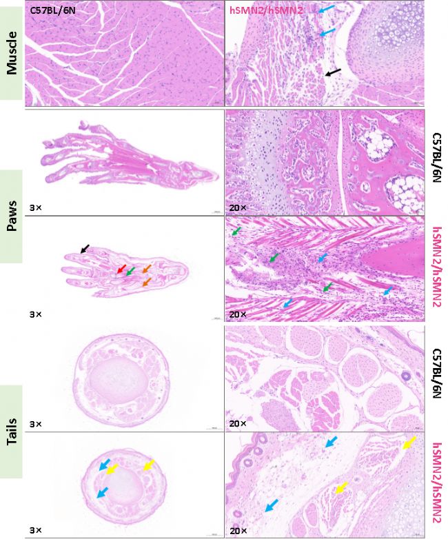 B6-hSMN2(SMA)С