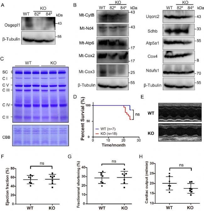 ˾wtRNA t6A(du)w_(d){(dio)صĶ